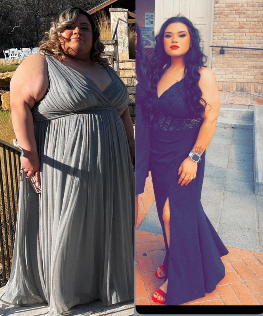 Before & After — DFW Medi Weight Loss Weight loss transformation with GLP-1 program at DFW Medi Weight Loss Clinic